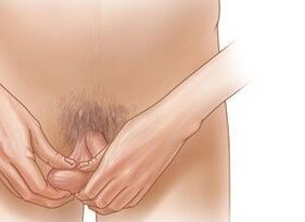 Exercices de jeling pour augmenter le pénis